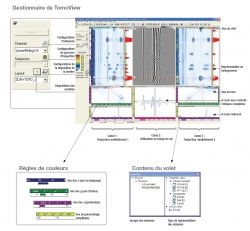 LOGICIEL ULTRASONORE TOMOVIEW